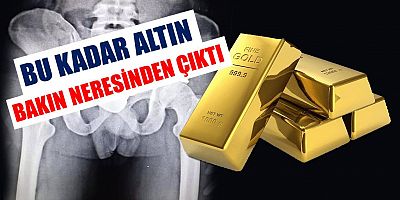 Bu Kadar Altın Bakın Nereden Çıktı!
